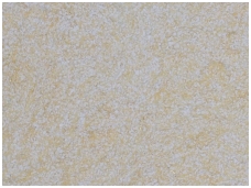 POLDECOR skysti tapetai TYP31 NR03